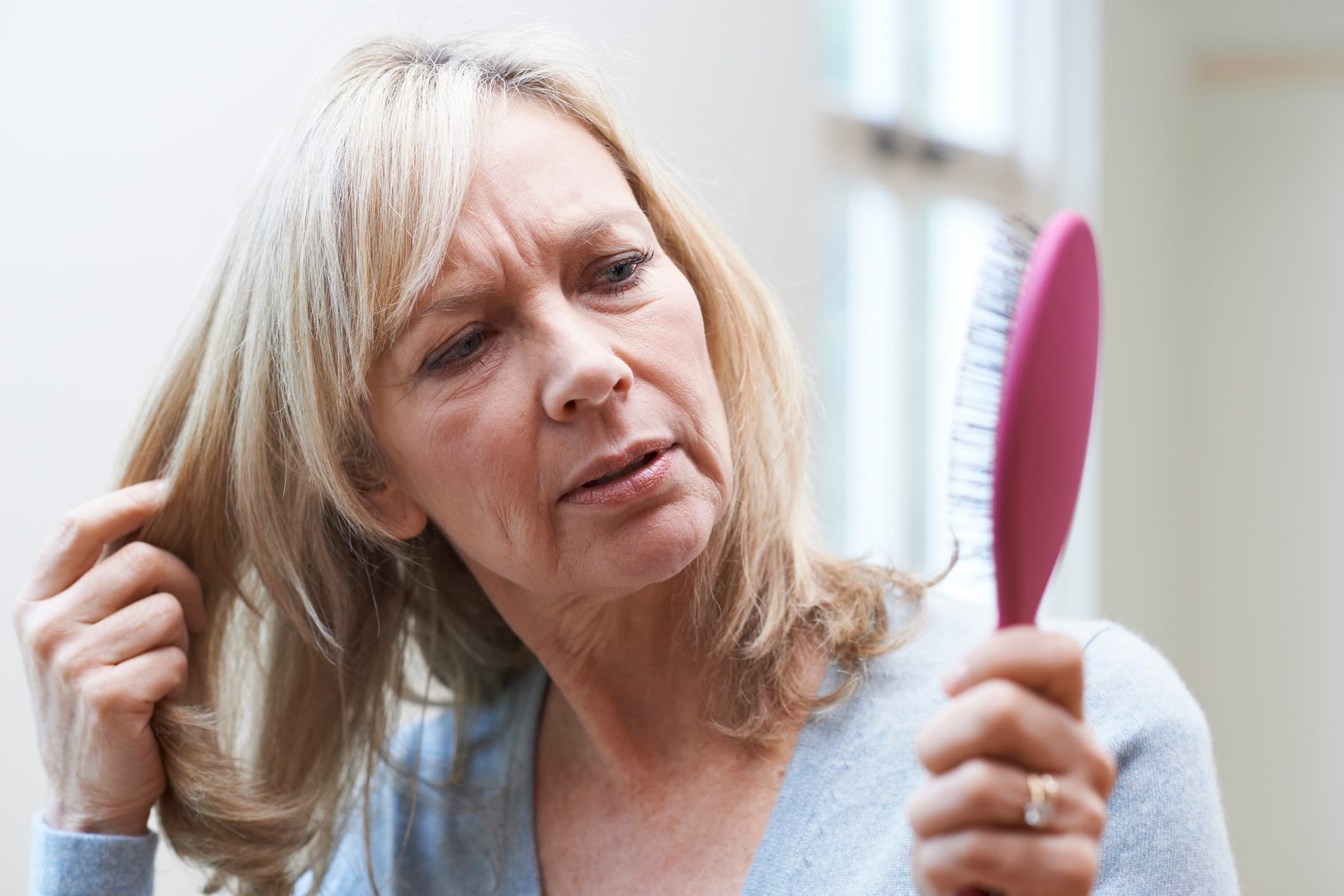 menopausal-hair-loss (1)